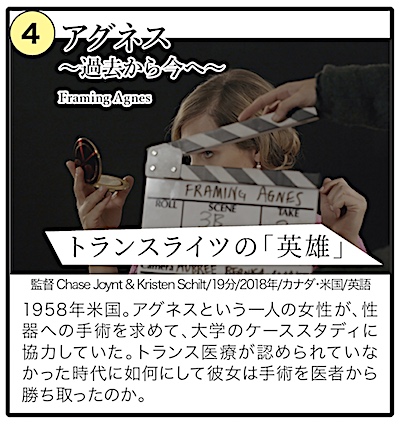 アグネス〜過去から今へ〜